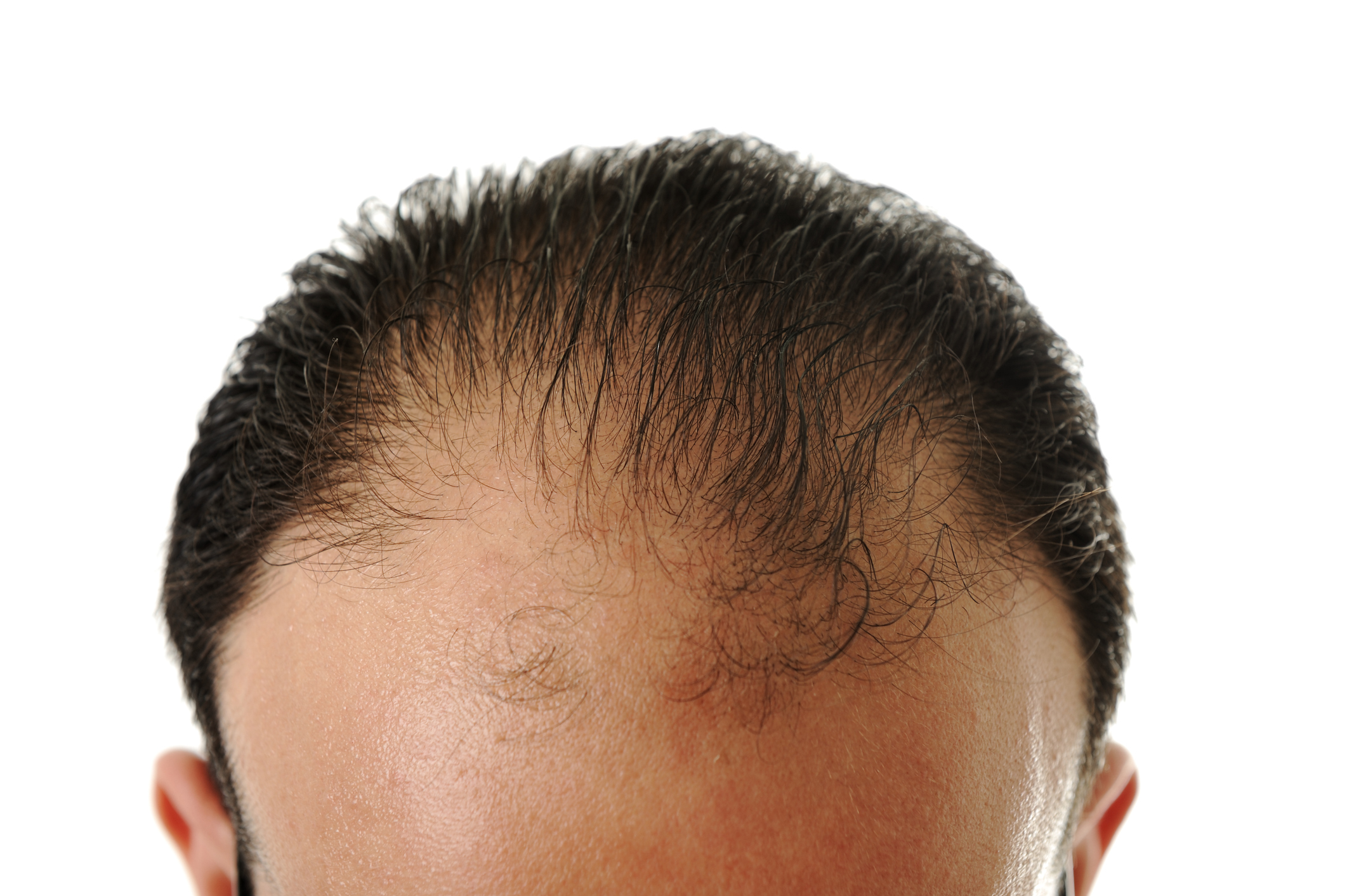 髪が細いのを改善したい 男性の髪が細くなる4つの要因とは 薄毛 抜け毛 頭皮の情報をご紹介 髪のせんせいmen Byスカルプdのアンファー