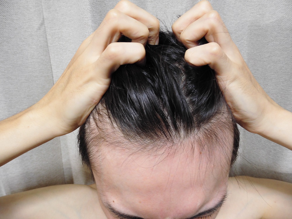 髪の毛がガタガタしている の悩みに ガタつく原因と直毛にする方法 薄毛 抜け毛 頭皮の情報をご紹介 髪 のせんせいmen Byスカルプdのアンファー