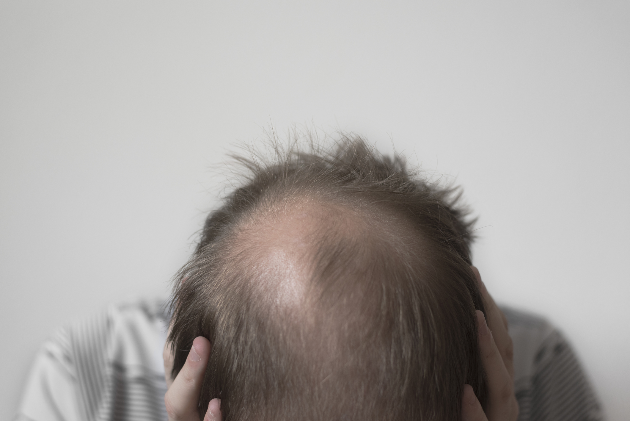 急に増えた白髪は病気のサインかも 白髪が増える4つの病気 薄毛 抜け毛 頭皮の情報をご紹介 髪のせんせいmen Byスカルプdのアンファー